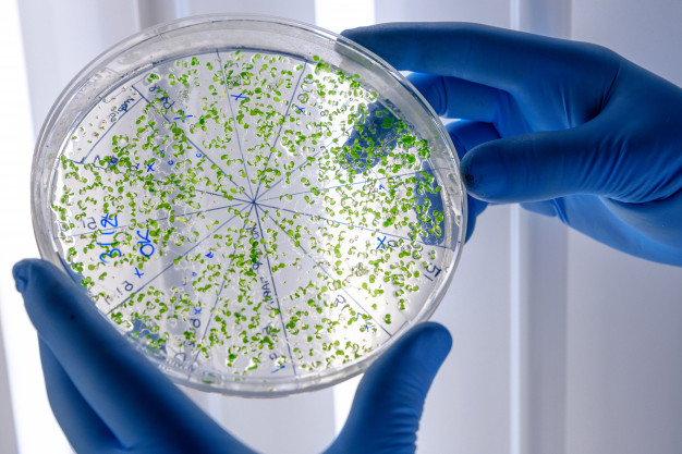 ¿Dónde estudiar la carrera profesionalr de Bacteriología en Lima?